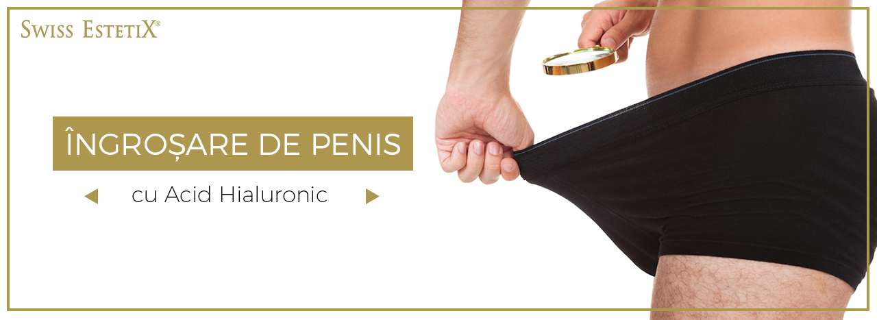 penisuri franceze