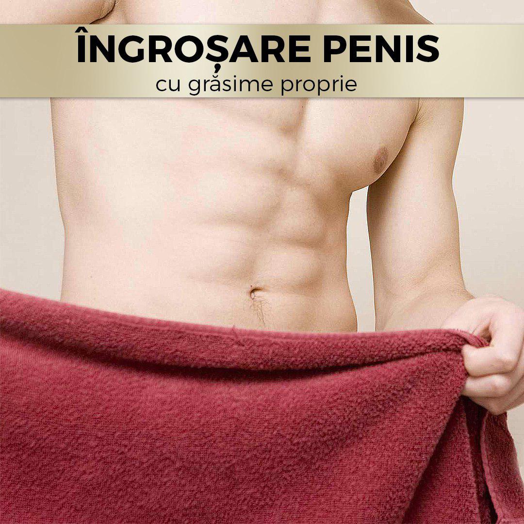 măriți lungimea penisului în timpul unei erecții bărbatul are o erecție lentă